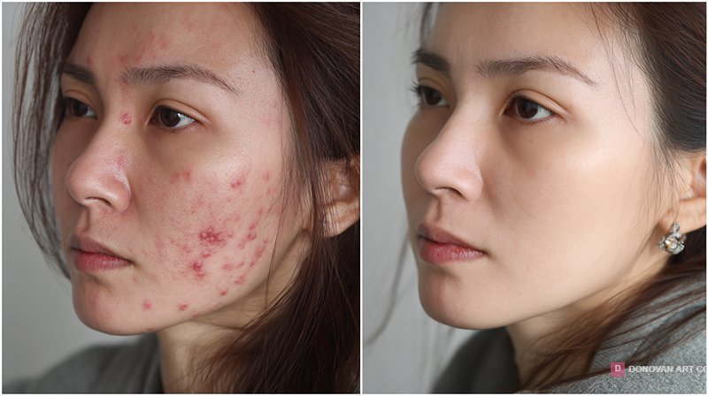 การเปลี่ยนแปลงผิวหน้าก่อนและหลังการรักษา